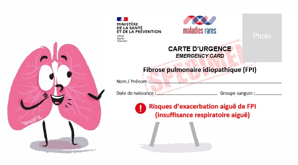 Voyager avec une Fibrose Pulmonaire (FP) : Les prcautions et conseils  pratiques | Vivre avec une Fibrose Pulmonaire