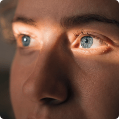 Generalized Pustular Psoriasis | GPP and Me