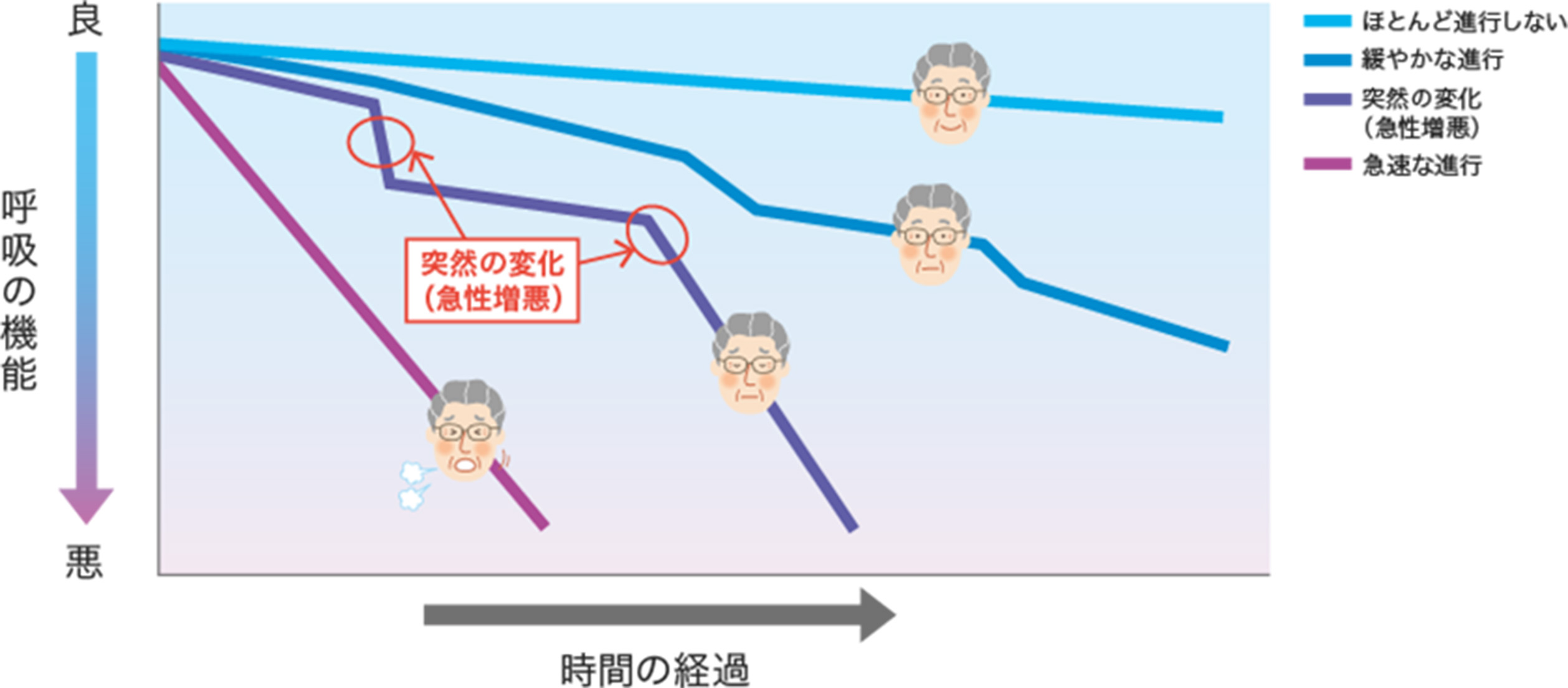 肺炎 末期