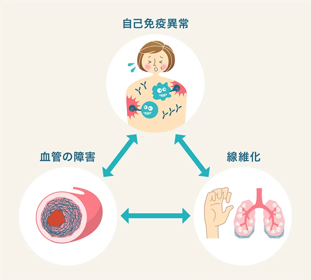 強 皮 症