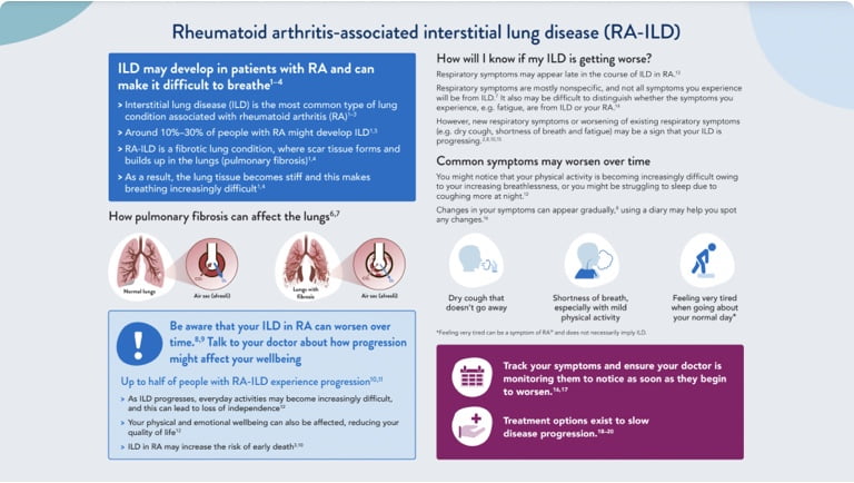Rheumatoid Arthritis Disease Progression: Signs Rheumatoid