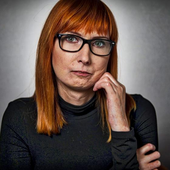 History of Anna's diagnosis | More Than Scleroderma